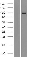 Western blot validation of overexpression lysate (Cat# LY422056) using anti-DDK antibody (Cat# TA50011-100). Left: Cell lysates from un-transfected HEK293T cells; Right: Cell lysates from HEK293T cells transfected with RC213724 using transfection reagent MegaTran 2.0 (Cat# TT210002).