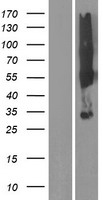 Western blot validation of overexpression lysate (Cat# LY420833) using anti-DDK antibody (Cat# TA50011-100). Left: Cell lysates from un-transfected HEK293T cells; Right: Cell lysates from HEK293T cells transfected with RC219117 using transfection reagent MegaTran 2.0 (Cat# TT210002).