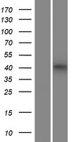 Western blot validation of overexpression lysate (Cat# LY420772) using anti-DDK antibody (Cat# TA50011-100). Left: Cell lysates from un-transfected HEK293T cells; Right: Cell lysates from HEK293T cells transfected with RC217682 using transfection reagent MegaTran 2.0 (Cat# TT210002).