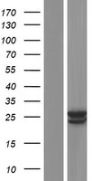 Western blot validation of overexpression lysate (Cat# LY421552) using anti-DDK antibody (Cat# TA50011-100). Left: Cell lysates from un-transfected HEK293T cells; Right: Cell lysates from HEK293T cells transfected with RC220651 using transfection reagent MegaTran 2.0 (Cat# TT210002).