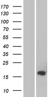 Western blot validation of overexpression lysate (Cat# LY421323) using anti-DDK antibody (Cat# TA50011-100). Left: Cell lysates from un-transfected HEK293T cells; Right: Cell lysates from HEK293T cells transfected with RC222847 using transfection reagent MegaTran 2.0 (Cat# TT210002).