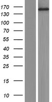 Western blot validation of overexpression lysate (Cat# LY420634) using anti-DDK antibody (Cat# TA50011-100). Left: Cell lysates from un-transfected HEK293T cells; Right: Cell lysates from HEK293T cells transfected with RC223108 using transfection reagent MegaTran 2.0 (Cat# TT210002).
