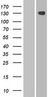 Western blot validation of overexpression lysate (Cat# LY420664) using anti-DDK antibody (Cat# TA50011-100). Left: Cell lysates from un-transfected HEK293T cells; Right: Cell lysates from HEK293T cells transfected with RC214648 using transfection reagent MegaTran 2.0 (Cat# TT210002).