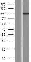 Western blot validation of overexpression lysate (Cat# LY420452) using anti-DDK antibody (Cat# TA50011-100). Left: Cell lysates from un-transfected HEK293T cells; Right: Cell lysates from HEK293T cells transfected with RC217120 using transfection reagent MegaTran 2.0 (Cat# TT210002).