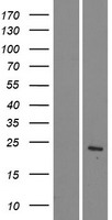 Western blot validation of overexpression lysate (Cat# LY426365) using anti-DDK antibody (Cat# TA50011-100). Left: Cell lysates from un-transfected HEK293T cells; Right: Cell lysates from HEK293T cells transfected with RC225263 using transfection reagent MegaTran 2.0 (Cat# TT210002).