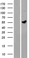 Western blot validation of overexpression lysate (Cat# LY426415) using anti-DDK antibody (Cat# TA50011-100). Left: Cell lysates from un-transfected HEK293T cells; Right: Cell lysates from HEK293T cells transfected with RC225767 using transfection reagent MegaTran 2.0 (Cat# TT210002).