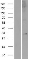 Western blot validation of overexpression lysate (Cat# LY427205) using anti-DDK antibody (Cat# TA50011-100). Left: Cell lysates from un-transfected HEK293T cells; Right: Cell lysates from HEK293T cells transfected with RC225381 using transfection reagent MegaTran 2.0 (Cat# TT210002).