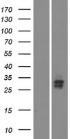 Western blot validation of overexpression lysate (Cat# LY428533) using anti-DDK antibody (Cat# TA50011-100). Left: Cell lysates from un-transfected HEK293T cells; Right: Cell lysates from HEK293T cells transfected with RC227422 using transfection reagent MegaTran 2.0 (Cat# TT210002).