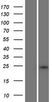 Western blot validation of overexpression lysate (Cat# LY431178) using anti-DDK antibody (Cat# TA50011-100). Left: Cell lysates from un-transfected HEK293T cells; Right: Cell lysates from HEK293T cells transfected with RC228150 using transfection reagent MegaTran 2.0 (Cat# TT210002).