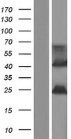 Western blot validation of overexpression lysate (Cat# LY431146) using anti-DDK antibody (Cat# TA50011-100). Left: Cell lysates from un-transfected HEK293T cells; Right: Cell lysates from HEK293T cells transfected with RC228118 using transfection reagent MegaTran 2.0 (Cat# TT210002).