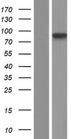 Western blot validation of overexpression lysate (Cat# LY433472) using anti-DDK antibody (Cat# TA50011-100). Left: Cell lysates from un-transfected HEK293T cells; Right: Cell lysates from HEK293T cells transfected with RC230472 using transfection reagent MegaTran 2.0 (Cat# TT210002).