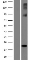 Western blot validation of overexpression lysate (Cat# LY433220) using anti-DDK antibody (Cat# TA50011-100). Left: Cell lysates from un-transfected HEK293T cells; Right: Cell lysates from HEK293T cells transfected with RC230220 using transfection reagent MegaTran 2.0 (Cat# TT210002).