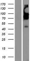 Western blot validation of overexpression lysate (Cat# LY433125) using anti-DDK antibody (Cat# TA50011-100). Left: Cell lysates from un-transfected HEK293T cells; Right: Cell lysates from HEK293T cells transfected with RC230125 using transfection reagent MegaTran 2.0 (Cat# TT210002).