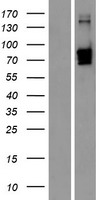 Western blot validation of overexpression lysate (Cat# LY433406) using anti-DDK antibody (Cat# TA50011-100). Left: Cell lysates from un-transfected HEK293T cells; Right: Cell lysates from HEK293T cells transfected with RC230406 using transfection reagent MegaTran 2.0 (Cat# TT210002).