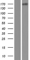 Western blot validation of overexpression lysate (Cat# LY419949) using anti-DDK antibody (Cat# TA50011-100). Left: Cell lysates from un-transfected HEK293T cells; Right: Cell lysates from HEK293T cells transfected with RC213157 using transfection reagent MegaTran 2.0 (Cat# TT210002).