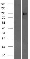 Western blot validation of overexpression lysate (Cat# LY415536) using anti-DDK antibody (Cat# TA50011-100). Left: Cell lysates from un-transfected HEK293T cells; Right: Cell lysates from HEK293T cells transfected with RC220977 using transfection reagent MegaTran 2.0 (Cat# TT210002).