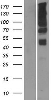 Western blot validation of overexpression lysate (Cat# LY415247) using anti-DDK antibody (Cat# TA50011-100). Left: Cell lysates from un-transfected HEK293T cells; Right: Cell lysates from HEK293T cells transfected with RC213084 using transfection reagent MegaTran 2.0 (Cat# TT210002).