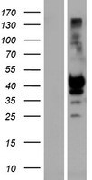 Western blot validation of overexpression lysate (Cat# LY415215) using anti-DDK antibody (Cat# TA50011-100). Left: Cell lysates from un-transfected HEK293T cells; Right: Cell lysates from HEK293T cells transfected with RC213484 using transfection reagent MegaTran 2.0 (Cat# TT210002).