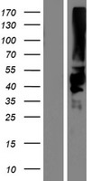 Western blot validation of overexpression lysate (Cat# LY415216) using anti-DDK antibody (Cat# TA50011-100). Left: Cell lysates from un-transfected HEK293T cells; Right: Cell lysates from HEK293T cells transfected with RC212212 using transfection reagent MegaTran 2.0 (Cat# TT210002).