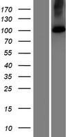 Western blot validation of overexpression lysate (Cat# LY414989) using anti-DDK antibody (Cat# TA50011-100). Left: Cell lysates from un-transfected HEK293T cells; Right: Cell lysates from HEK293T cells transfected with RC212990 using transfection reagent MegaTran 2.0 (Cat# TT210002).
