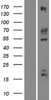 Western blot validation of overexpression lysate (Cat# LY414881) using anti-DDK antibody (Cat# TA50011-100). Left: Cell lysates from un-transfected HEK293T cells; Right: Cell lysates from HEK293T cells transfected with RC219140 using transfection reagent MegaTran 2.0 (Cat# TT210002).