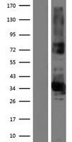 Western blot validation of overexpression lysate (Cat# LY414254) using anti-DDK antibody (Cat# TA50011-100). Left: Cell lysates from un-transfected HEK293T cells; Right: Cell lysates from HEK293T cells transfected with RC217164 using transfection reagent MegaTran 2.0 (Cat# TT210002).