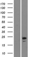 Western blot validation of overexpression lysate (Cat# LY413919) using anti-DDK antibody (Cat# TA50011-100). Left: Cell lysates from un-transfected HEK293T cells; Right: Cell lysates from HEK293T cells transfected with RC219393 using transfection reagent MegaTran 2.0 (Cat# TT210002).