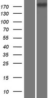 Western blot validation of overexpression lysate (Cat# LY413720) using anti-DDK antibody (Cat# TA50011-100). Left: Cell lysates from un-transfected HEK293T cells; Right: Cell lysates from HEK293T cells transfected with RC222875 using transfection reagent MegaTran 2.0 (Cat# TT210002).