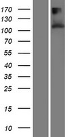 Western blot validation of overexpression lysate (Cat# LY413492) using anti-DDK antibody (Cat# TA50011-100). Left: Cell lysates from un-transfected HEK293T cells; Right: Cell lysates from HEK293T cells transfected with RC214846 using transfection reagent MegaTran 2.0 (Cat# TT210002).