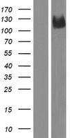 Western blot validation of overexpression lysate (Cat# LY412910) using anti-DDK antibody (Cat# TA50011-100). Left: Cell lysates from un-transfected HEK293T cells; Right: Cell lysates from HEK293T cells transfected with RC218304 using transfection reagent MegaTran 2.0 (Cat# TT210002).