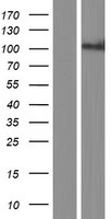 Western blot validation of overexpression lysate (Cat# LY412923) using anti-DDK antibody (Cat# TA50011-100). Left: Cell lysates from un-transfected HEK293T cells; Right: Cell lysates from HEK293T cells transfected with RC218888 using transfection reagent MegaTran 2.0 (Cat# TT210002).