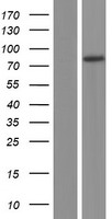 Western blot validation of overexpression lysate (Cat# LY412482) using anti-DDK antibody (Cat# TA50011-100). Left: Cell lysates from un-transfected HEK293T cells; Right: Cell lysates from HEK293T cells transfected with RC212158 using transfection reagent MegaTran 2.0 (Cat# TT210002).