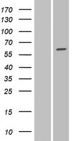 Western blot validation of overexpression lysate (Cat# LY412386) using anti-DDK antibody (Cat# TA50011-100). Left: Cell lysates from un-transfected HEK293T cells; Right: Cell lysates from HEK293T cells transfected with RC222358 using transfection reagent MegaTran 2.0 (Cat# TT210002).