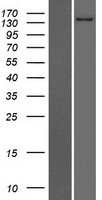 Western blot validation of overexpression lysate (Cat# LY412223) using anti-DDK antibody (Cat# TA50011-100). Left: Cell lysates from un-transfected HEK293T cells; Right: Cell lysates from HEK293T cells transfected with RC224006 using transfection reagent MegaTran 2.0 (Cat# TT210002).