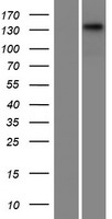Western blot validation of overexpression lysate (Cat# LY411574) using anti-DDK antibody (Cat# TA50011-100). Left: Cell lysates from un-transfected HEK293T cells; Right: Cell lysates from HEK293T cells transfected with RC212957 using transfection reagent MegaTran 2.0 (Cat# TT210002).