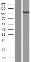 Western blot validation of overexpression lysate (Cat# LY410501) using anti-DDK antibody (Cat# TA50011-100). Left: Cell lysates from un-transfected HEK293T cells; Right: Cell lysates from HEK293T cells transfected with RC212283 using transfection reagent MegaTran 2.0 (Cat# TT210002).