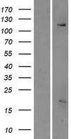 Western blot validation of overexpression lysate (Cat# LY410442) using anti-DDK antibody (Cat# TA50011-100). Left: Cell lysates from un-transfected HEK293T cells; Right: Cell lysates from HEK293T cells transfected with RC218538 using transfection reagent MegaTran 2.0 (Cat# TT210002).