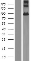 Western blot validation of overexpression lysate (Cat# LY410383) using anti-DDK antibody (Cat# TA50011-100). Left: Cell lysates from un-transfected HEK293T cells; Right: Cell lysates from HEK293T cells transfected with RC222084 using transfection reagent MegaTran 2.0 (Cat# TT210002).
