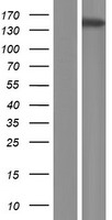 Western blot validation of overexpression lysate (Cat# LY410292) using anti-DDK antibody (Cat# TA50011-100). Left: Cell lysates from un-transfected HEK293T cells; Right: Cell lysates from HEK293T cells transfected with RC223785 using transfection reagent MegaTran 2.0 (Cat# TT210002).