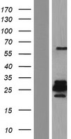Western blot validation of overexpression lysate (Cat# LY409999) using anti-DDK antibody (Cat# TA50011-100). Left: Cell lysates from un-transfected HEK293T cells; Right: Cell lysates from HEK293T cells transfected with RC212089 using transfection reagent MegaTran 2.0 (Cat# TT210002).