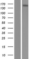Western blot validation of overexpression lysate (Cat# LY409514) using anti-DDK antibody (Cat# TA50011-100). Left: Cell lysates from un-transfected HEK293T cells; Right: Cell lysates from HEK293T cells transfected with RC221247 using transfection reagent MegaTran 2.0 (Cat# TT210002).