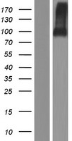Western blot validation of overexpression lysate (Cat# LY409403) using anti-DDK antibody (Cat# TA50011-100). Left: Cell lysates from un-transfected HEK293T cells; Right: Cell lysates from HEK293T cells transfected with RC220470 using transfection reagent MegaTran 2.0 (Cat# TT210002).