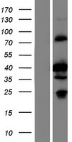 Western blot validation of overexpression lysate (Cat# LY408370) using anti-DDK antibody (Cat# TA50011-100). Left: Cell lysates from un-transfected HEK293T cells; Right: Cell lysates from HEK293T cells transfected with RC215543 using transfection reagent MegaTran 2.0 (Cat# TT210002).