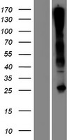 Western blot validation of overexpression lysate (Cat# LY407520) using anti-DDK antibody (Cat# TA50011-100). Left: Cell lysates from un-transfected HEK293T cells; Right: Cell lysates from HEK293T cells transfected with RC217893 using transfection reagent MegaTran 2.0 (Cat# TT210002).