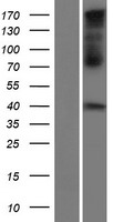 Western blot validation of overexpression lysate (Cat# LY407080) using anti-DDK antibody (Cat# TA50011-100). Left: Cell lysates from un-transfected HEK293T cells; Right: Cell lysates from HEK293T cells transfected with RC222438 using transfection reagent MegaTran 2.0 (Cat# TT210002).