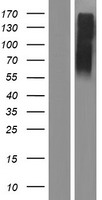 Western blot validation of overexpression lysate (Cat# LY407035) using anti-DDK antibody (Cat# TA50011-100). Left: Cell lysates from un-transfected HEK293T cells; Right: Cell lysates from HEK293T cells transfected with RC216671 using transfection reagent MegaTran 2.0 (Cat# TT210002).
