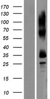 Western blot validation of overexpression lysate (Cat# LY406802) using anti-DDK antibody (Cat# TA50011-100). Left: Cell lysates from un-transfected HEK293T cells; Right: Cell lysates from HEK293T cells transfected with RC211393 using transfection reagent MegaTran 2.0 (Cat# TT210002).