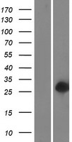 Western blot validation of overexpression lysate (Cat# LY406202) using anti-DDK antibody (Cat# TA50011-100). Left: Cell lysates from un-transfected HEK293T cells; Right: Cell lysates from HEK293T cells transfected with RC224815 using transfection reagent MegaTran 2.0 (Cat# TT210002).