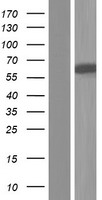 Western blot validation of overexpression lysate (Cat# LY406005) using anti-DDK antibody (Cat# TA50011-100). Left: Cell lysates from un-transfected HEK293T cells; Right: Cell lysates from HEK293T cells transfected with RC216687 using transfection reagent MegaTran 2.0 (Cat# TT210002).