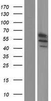 Western blot validation of overexpression lysate (Cat# LY405620) using anti-DDK antibody (Cat# TA50011-100). Left: Cell lysates from un-transfected HEK293T cells; Right: Cell lysates from HEK293T cells transfected with RC214259 using transfection reagent MegaTran 2.0 (Cat# TT210002).